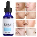 30ml Glycolic Acid Peel Repair Face Serum Solution Shrink Pores Brighten Skin Color Balance Water And Oil Improve Acne Skin Care