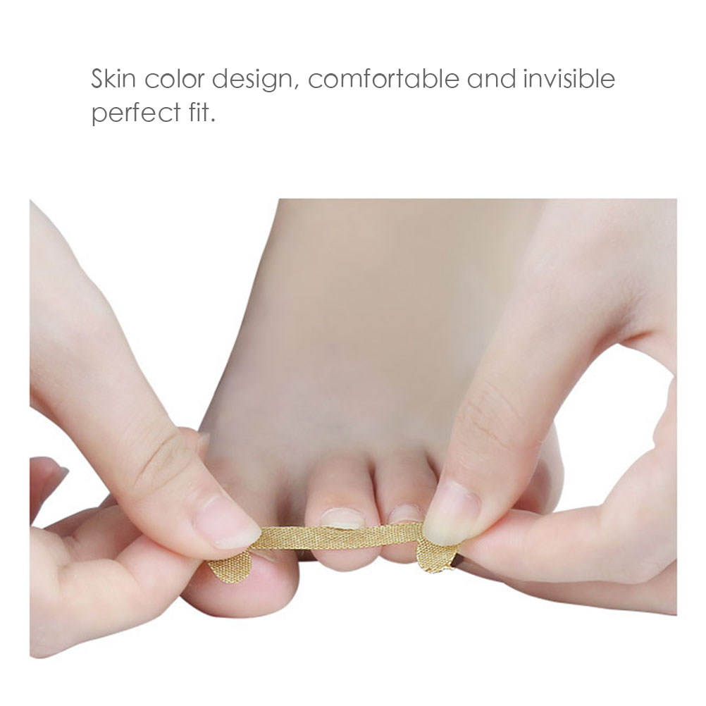 20pcs Professional Embedded Toe Nail Corrector Sticker Toenail Care Pedicure Thumb Curl Correction Sticker