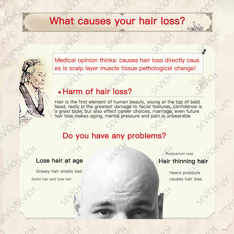 Sevich Hair Growth Spray 30ml Hair Loss Product Hair Regrowth Spray Anti Hair Loss Treatment Thicken Thin Hair TSLM1
