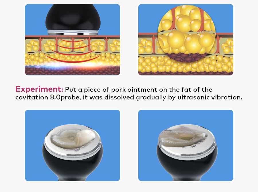 lipo cavitation 80k