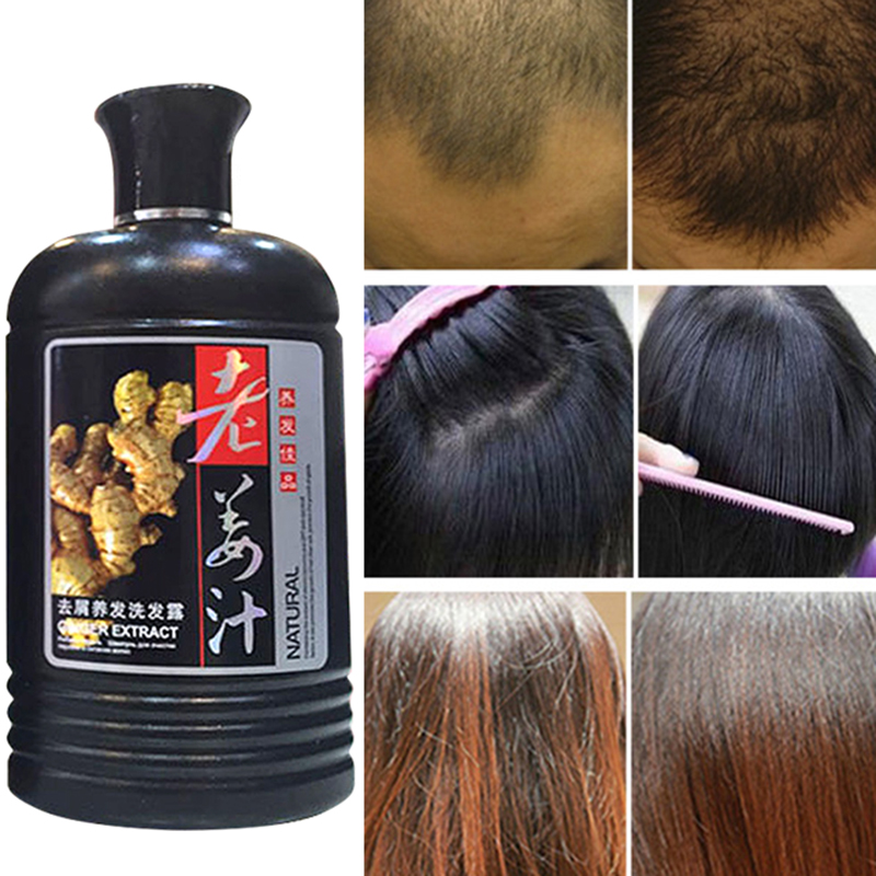 Andrea-Growth-Essence-Hair-Loss-Liquid-20ml-dense-hair-Fast-Essence-alopecia-hair-loss-liquid-Ginger.jpg_640x640