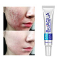 BIOAQUA Anti Acne Cream Removal Of Acne Removal Of Blackheads Whitening Cream Scar Remove Reduce Acne Oil Control Shrink Pores
