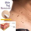 12 Hours Black Dots Mole Wart Skin Tag Remover Liquid Medical Corn Removal Foot Genital Care Mole Removal Papillomas Treatment