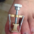 1pcs Professional Ingrown Toe Nail Correction Tool Pedicure Tool Foot Nail Care Foot Care Tool