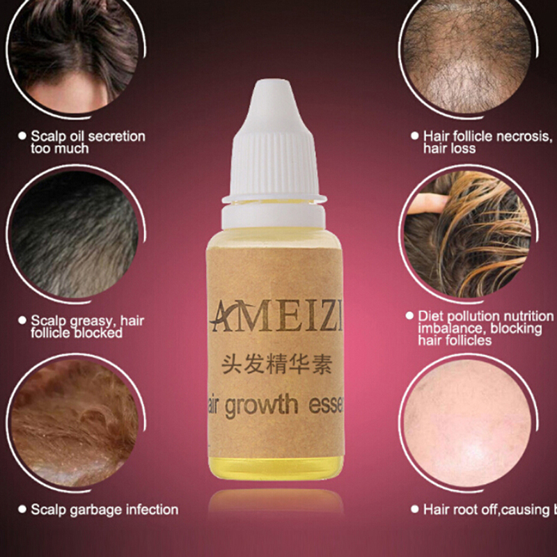 20ml/bottle Hair Growth Essence Anti Hair Loss Liquid Dense Hair Fast Sunburst Hair Growth Grow Alopecia