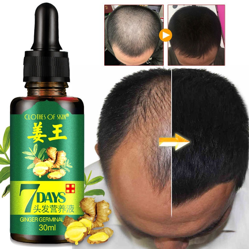 Ginger Germinal Oil Hair Nutrient Solution Hair Growth Essence Liquid Fast Hair Natural Hair Loss Treatment Hair Care TSLM1