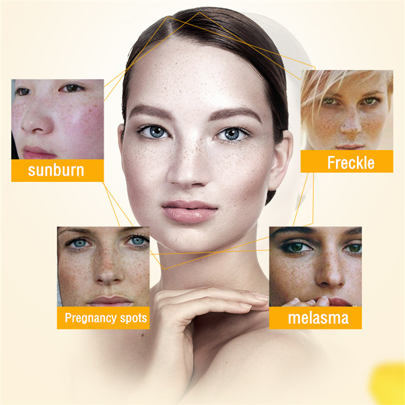 Dimollarue Retinol whitening Freckle cream Vitamin C Remove melasma pigment Melanin sunburn Pregnancy Acne brown Spots