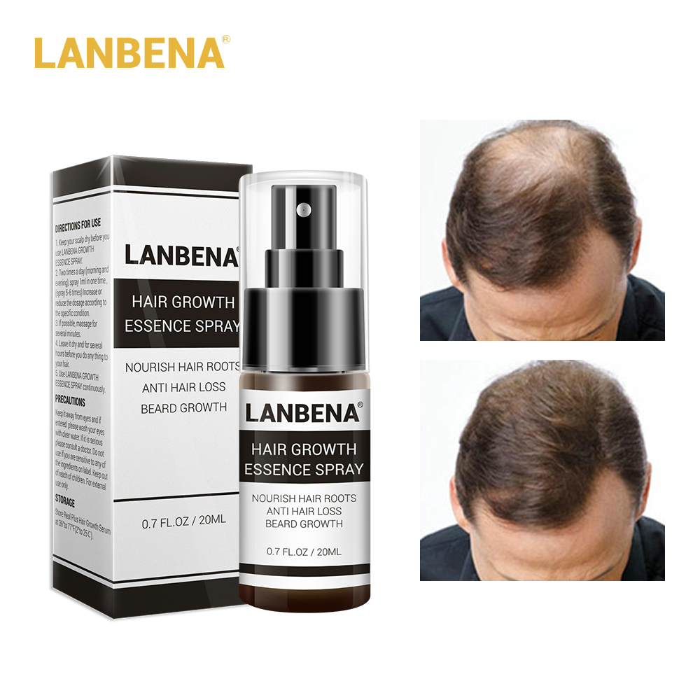 LANBENA Fast Powerful Hair Growth Essence Spray Preventing Baldness Consolidating Anti Hair Loss Nourish Root Hair Care Product