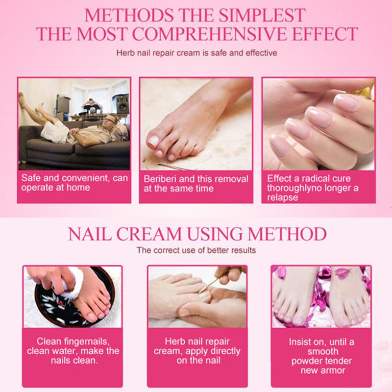 Nail Repair Cream Protector Skin Care Cream Toe Nail Fungus Treatment Herb Nail Repair Cream Podiatry Softener Remover Cuticle