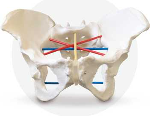 Female pelvis for pelviometry
