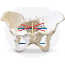 Female pelvis for pelviometry