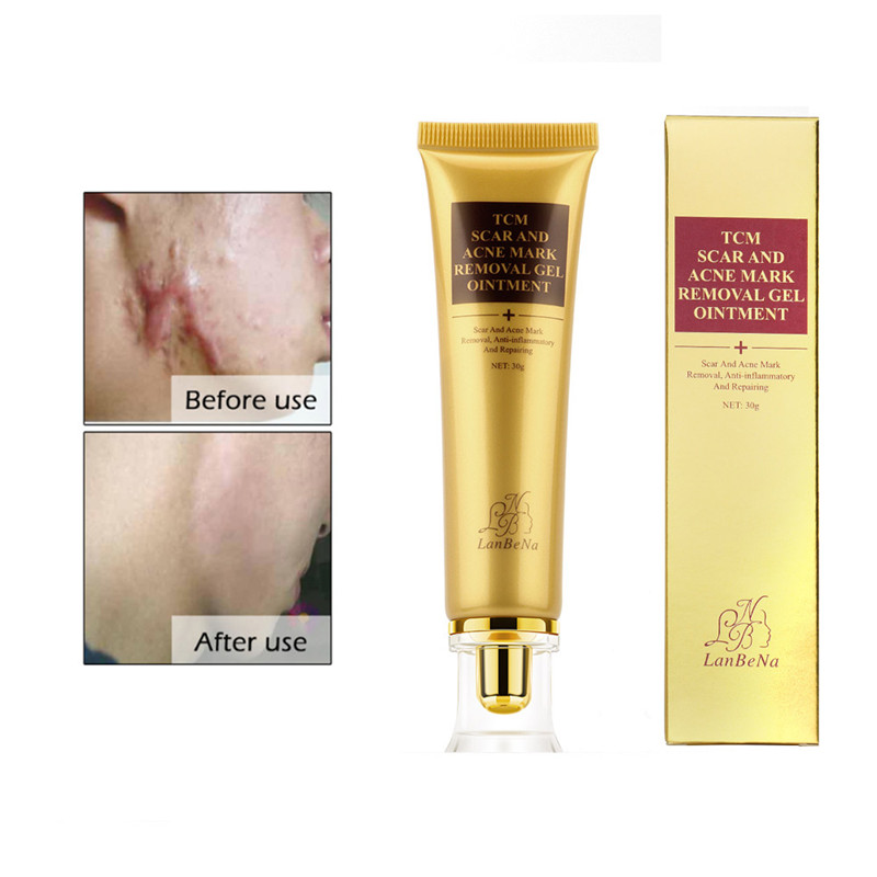 LANBENA Acne Scar Removal Cream Skin Repair Face Cream Acne Spots Treatment Stretch Marks Remove Postpartum Body Skin Cream