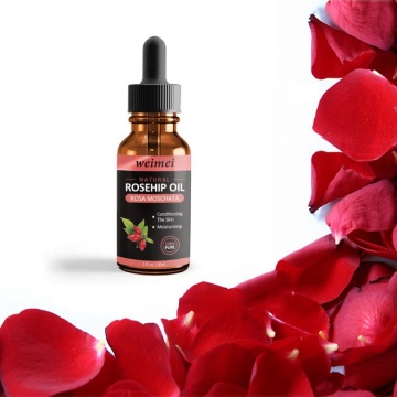 Natural Organic Rosehip Seed Oil Moisturizing Brighten Skin Color Essential Oil Anti-Dry Anti-Aging Face Essential Oil