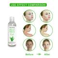 Aloe Vera Gel Face Brighten Moisturizing Anti-wrinkle Cream Reduce Acne Scar Skin Sunscreen Acne Treatment Skin Care Tool TSLM1