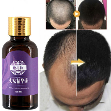 Natural With No Side Effects Hair Care Essence Prevention Hair Loss Effective Fast Hair Growth Nourishes Oil Control Repair