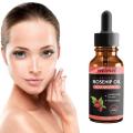 Organic Rosehip Seed Oil Moisturizing Brighten Skin Color Anti-Dry Anti-Aging Face Care Essential Oil