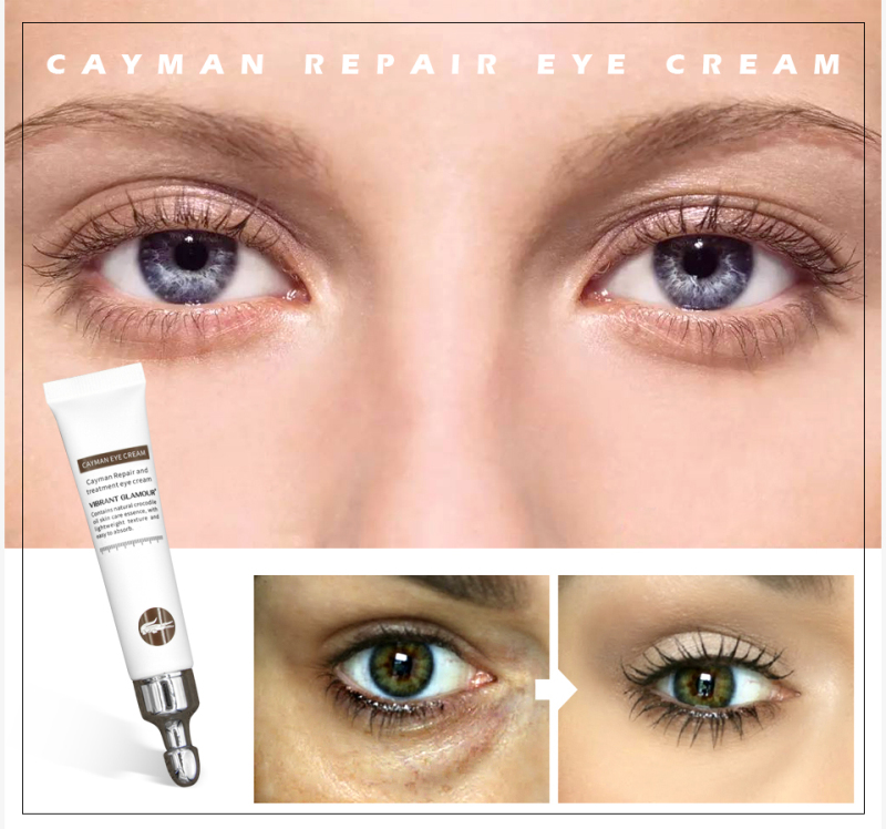 Hyaluronic Anti-wrinkle Age Eye Cream Crocodile Remover Dark Circles Against Acid Essence Moisturizing Firming Eye Serum TSLM2