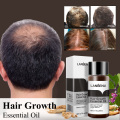 LANBENA Ginger Hair Growth Essential Oil Anti-hair Loss Nourish Hair Roots Consolidate Hair Loss Serum Hair Regeneration Product