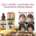 Oriental Oils Hair Nutrition Hair Loss Treatment Solutions Product Fast Hair Growth Remedy Essence Oil Hair Regrowth Products