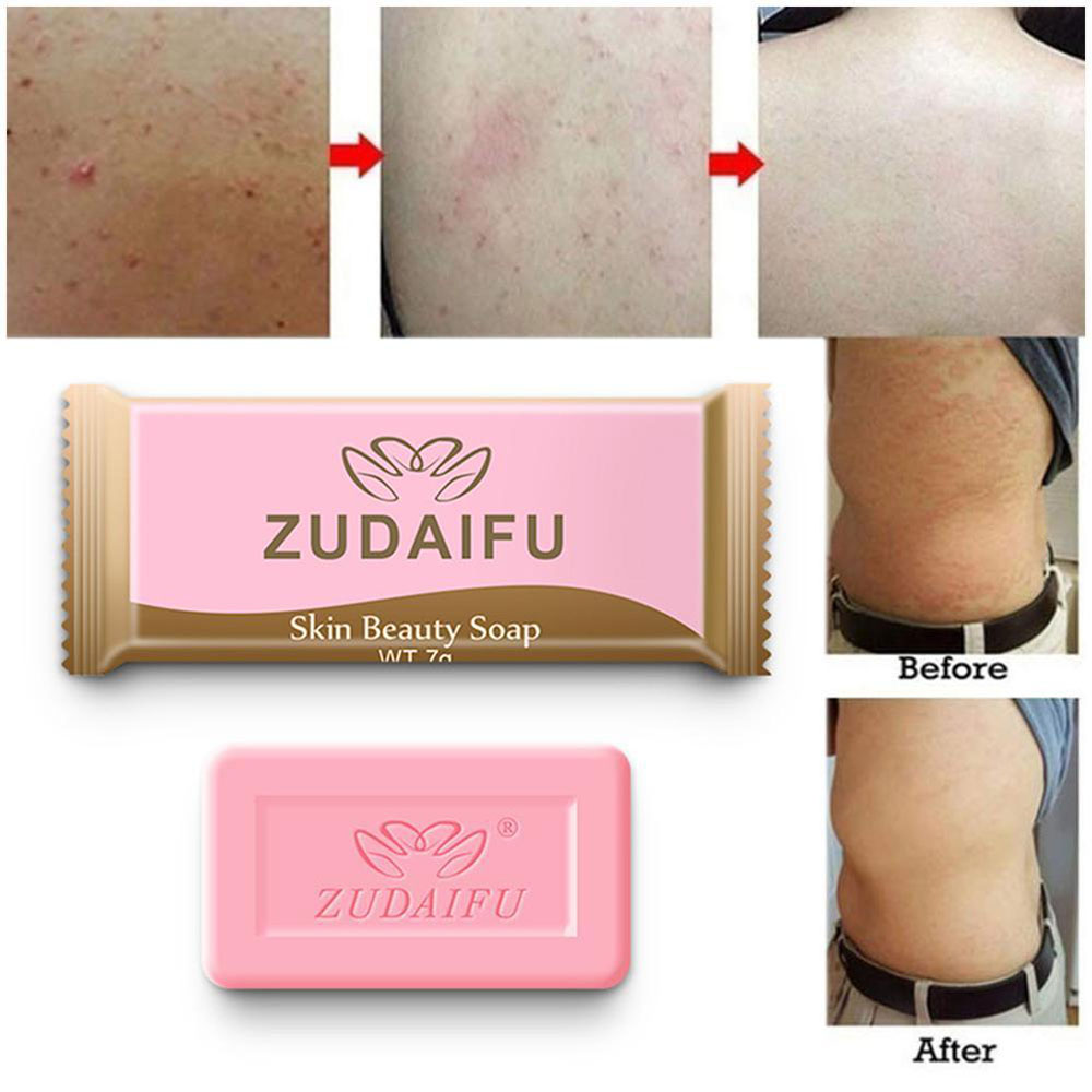 1/2PCS 7g Sulfur Soap Skin Conditions Acne Psoriasis Seborrhea Eczema Anti Fungus Bath Whitening Soap Shampoo dropship TSLM1