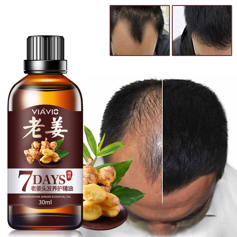 30ml Hair Loss Treatment Fast Hair Growth Dense Regrowth Ginger Serum Oil Effective Repair Damaged Hair Nourish Hair TSLM2