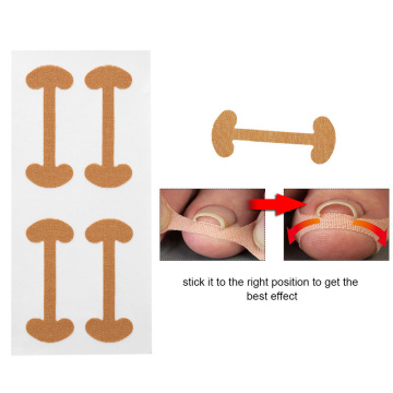 8 Pcs Ingrown Toenail Corrector Stickers Fingernail Paronychia Treatment Toe Nail Care Repairing Corrector Pedicure Tools