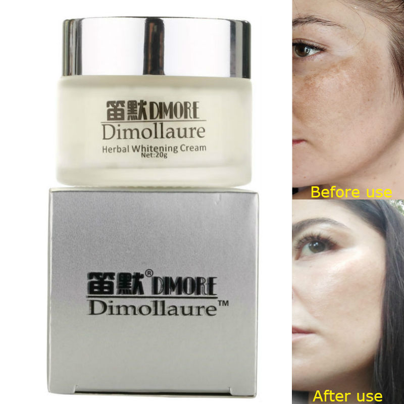 Dimollaure whitening Freckle cream kojic acid cream Retinol cream melasma Remove Acne Spots pigment Melanin face care cream