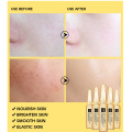 SENANA Face Serum Skin Whitening Essence Hyaluronic Acid Nicotinamide Ampoule Anti-Aging Acne Shrink Pores Hydration Skin Care