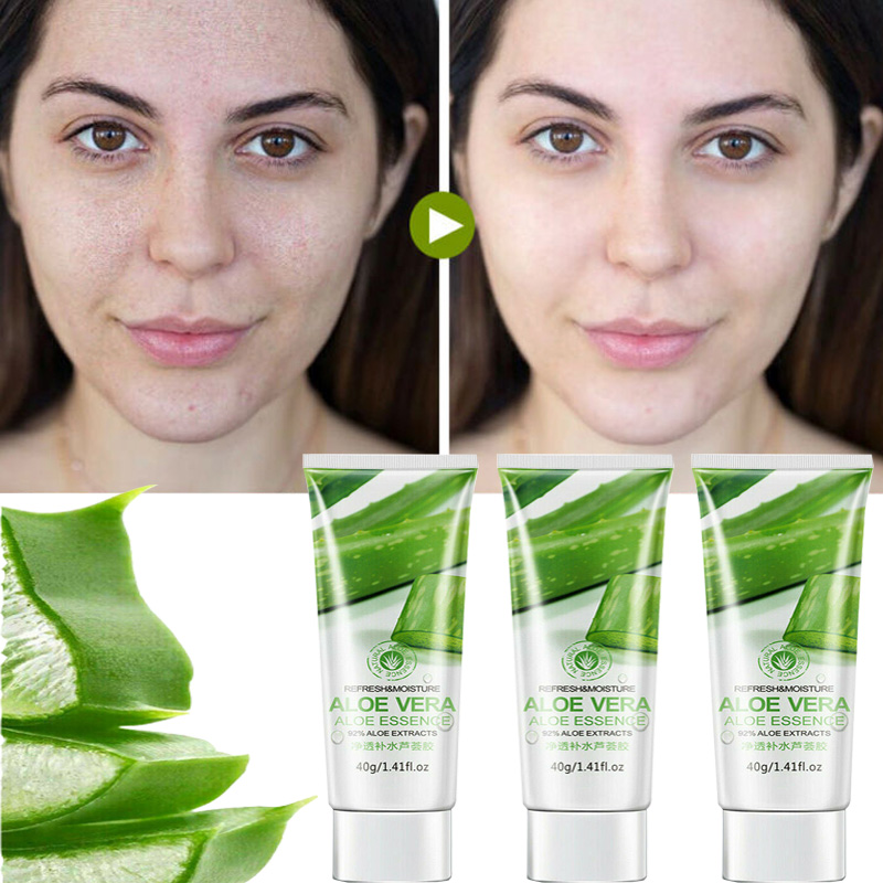 Natural Aloe Vera Gel Cream Moisturizing Anti-Wrinkle Cream Acne Scars Whitening Skin Sunscreen Acne Treatment Skin Care