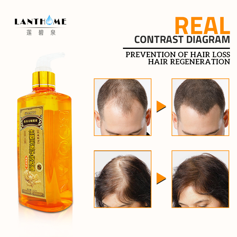 Genuine Professional Hair Ginger Shampoo 300ml Hair Regrowth Dense Fast Thicker Shampoo Anti Hair Loss Product