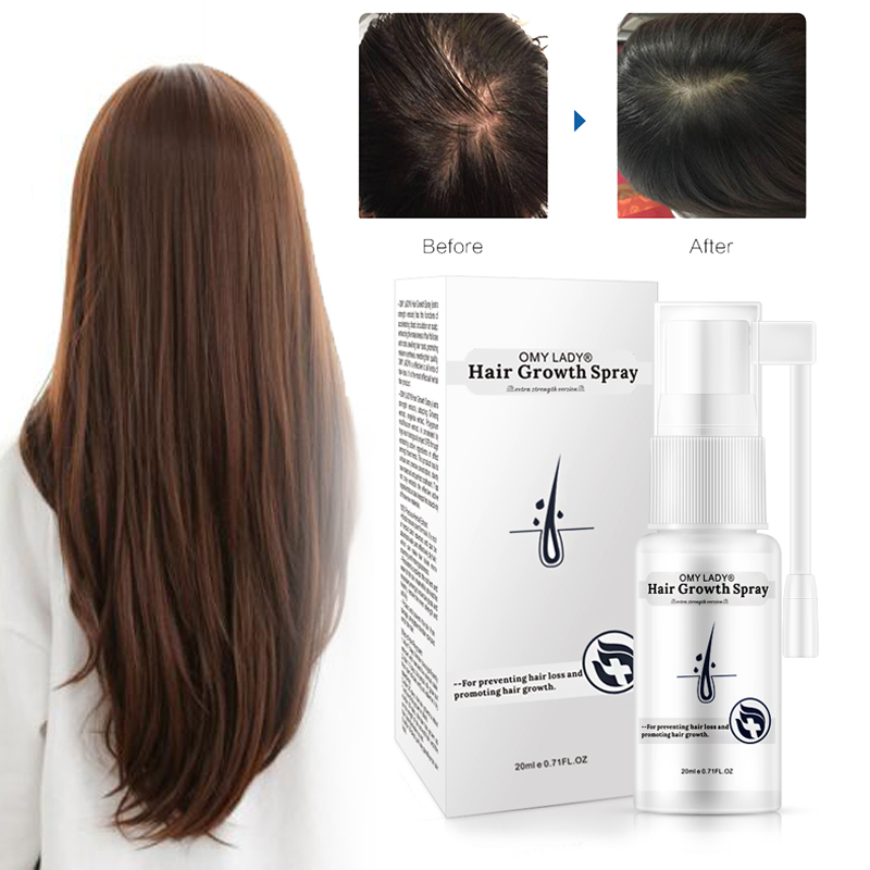 OMY LADY Hair Growth Essence Oil Anti-Hair Loss Hair Care Fluid Spray Hair Growth Ointment For Women/Men 20ml Dense Health Care