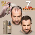 PURC New Hair Growth Spray Fast Grow Hair Hair Loss Treatment Preventing Hair Loss 30ml for Men Women