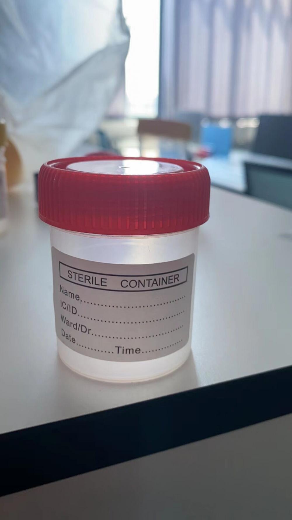 Urine Cup 1 Jpg