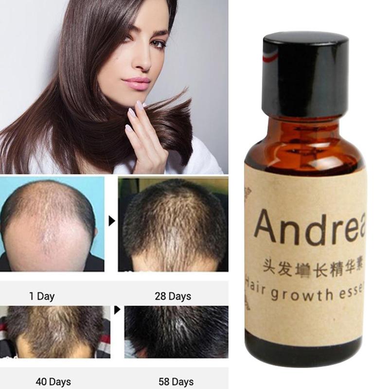 Andrea Fast Hair Growth Alopecia Loss Liquid Ginger Sunburst Yuda Pilatory Oil 20ml Natural Organic Regrowth Treatment