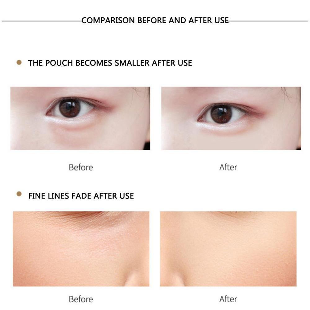 2 Minutes Instantly Eye Bag Removal Cream Long Lasting Effect Puffiness Wrinkles Fine Lines Remove Eye Cream for Women Men