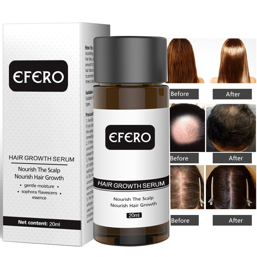 EFERO 3pcs/lot Hair Growth Hair Faster Regrowth Anti Hair Loss Building Beauty Dense Repair Restoration Treatment Serum