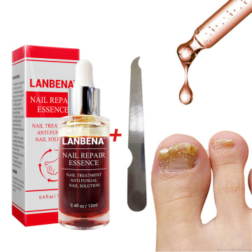 LANBENA Nail Repair Liquid Treatment with File Nail Anti Remove Nail Onychomycosis Fungus Toe Nourishing Brighten Nail TSLM1