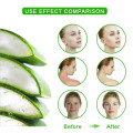 92% Natural Aloe Vera Gel Face Cream Acne Treatment Scar Remove Sunburn Repair Aloe Cream Moisturizing Soothing Sleep Mask