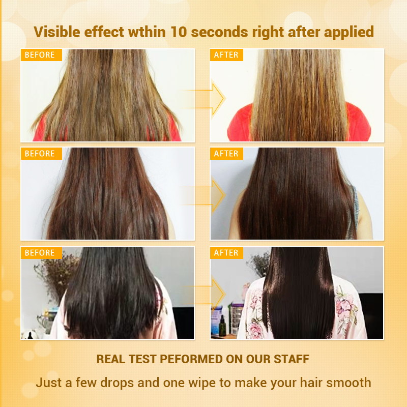 OMYLADY Anti Hair Loss Hair Growth Spray Essential Liquid+Natural Hair Essential Oil Deep Nourish Hairlines Repair Damaged Hair
