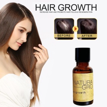 1PCS Hair Growth Liquid Ginger Germinal Serum Liquid Treatement Growth Hair Anti Hair Loss Serum Hair Repair Hair Care TSLM1