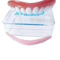 Perfect Smile Veneers In Stock Correction Teeth False Denture Bad Teeth Veneers Teeth Whitening Tooth Care