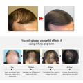 20ml Hair Growth Essence Faster Hair Growth Serum Damaged Hair Repair Essence Strong Anti-off Effectively Suppresses Dandruff