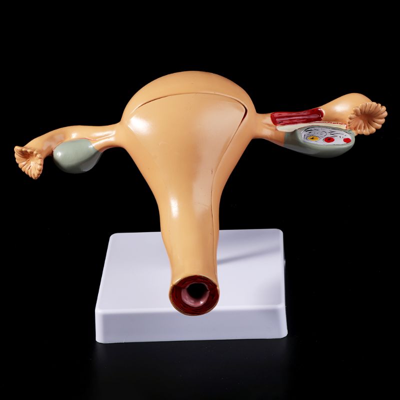 Medical props model Human Pathological Uterus Ovary Model Anatomical Anatomy Disease Pathology Medical Lesion For Teaching