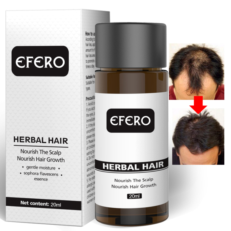 Efero Hair Care Hair Growth Essential Oils Hair Loss Dense Hair Fast Hair Growth Oil Grow Restoration Growing Serum TSLM2