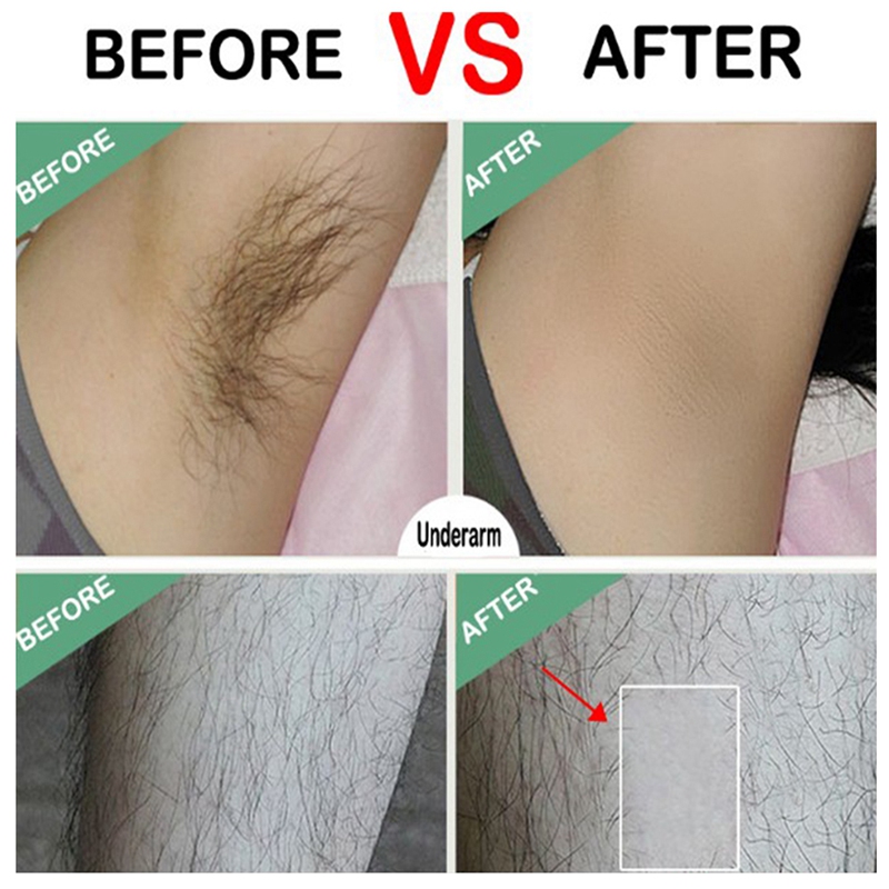 24 Pcs Hair Removal Depilatory Nonwoven Epilator Cold Wax Strip Paper Pad Patch Waxing for Body Bikini Face Armpit Legs