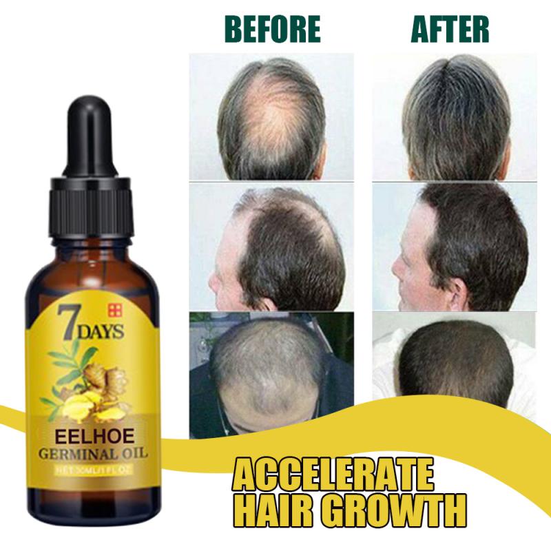 7-day Ginger Fast Hair Growth Serum Essential Oil Anti Preventing Hair Lose Liquid Damaged Hair Repair Growing Dropship TSLM1