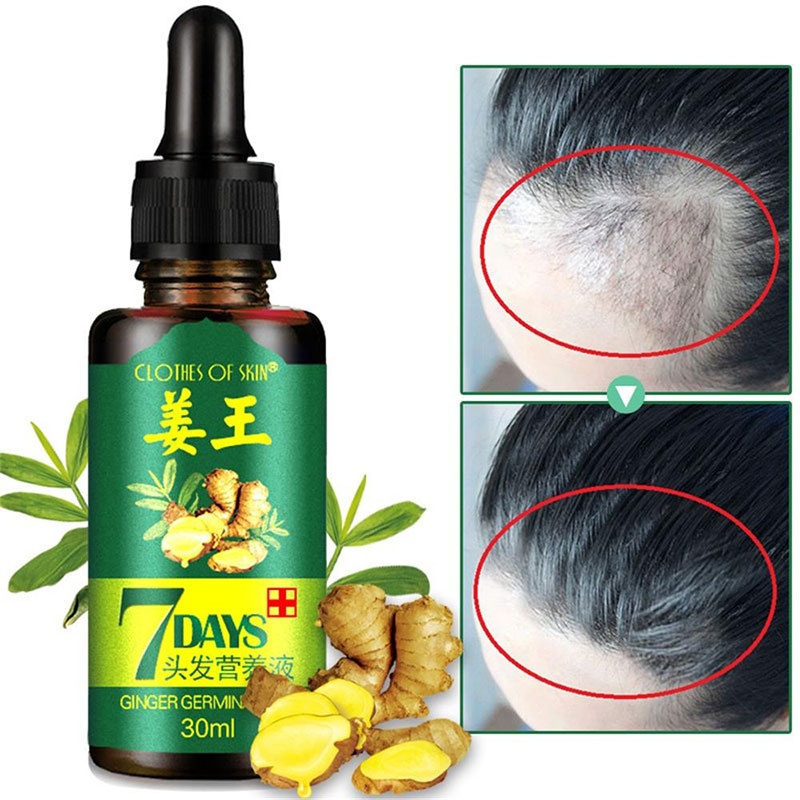 7 Day Ginger Germinal Serum Essence Oil Loss Treatement Growth Hair 30ML Healthy Hair Growth Essence Oil TSLM1