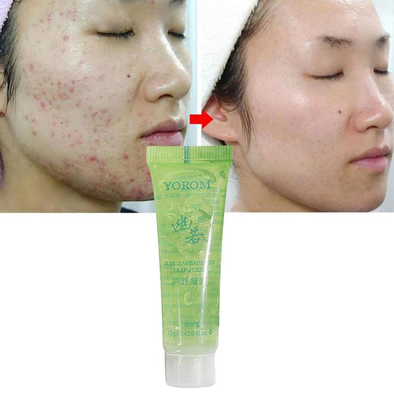 1Pcs Beauty Aloe Vera Gel After Sun Repair Cream Moisturizing Whitening Anti Winkles Aging Cream Sunscreen Face Care Freeshiping