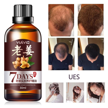 30ML Unisex Effective Hair Loss Treatment Hair Growth Ointment Hair Care Healthy Hair Growth Essence Oil TSLM2