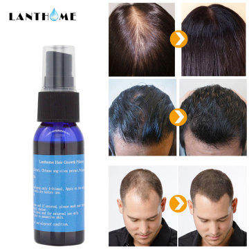 Professional Herb Hair Growth Liquid Hair Care Hair Growth Essential Oil Hair Serum Anti Loss Treatment Products